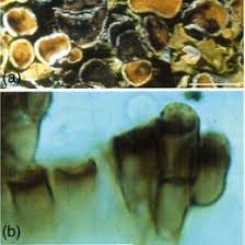 Attēlu rezultāti vaicājumam “Xanthoriicola physciae”