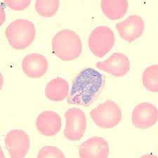 Attēlu rezultāti vaicājumam “Diderma cingulatum plasmodium”