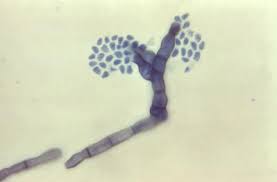 Attēlu rezultāti vaicājumam “Conardia compacta”