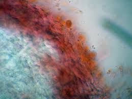 Attēlu rezultāti vaicājumam “Elmerina caryae”