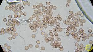 Attēlu rezultāti vaicājumam “Stemonitopsis typhina spores”