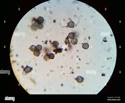 Attēlu rezultāti vaicājumam “Physarum psittacinum spores”