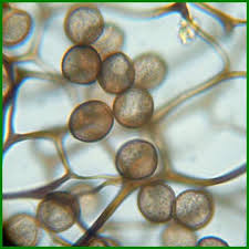 Attēlu rezultāti vaicājumam “Comatricha ellae spores”