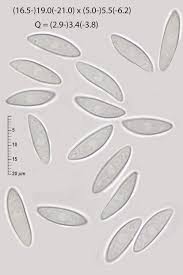 Attēlu rezultāti vaicājumam “Cudoniella acicularis”