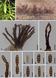 Attēlu rezultāti vaicājumam “Rosellinia desmazieri spores”