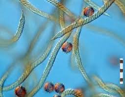 Attēlu rezultāti vaicājumam “Oligonema favogineum spores”