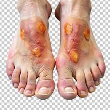 Attēlu rezultāti vaicājumam “Tetratoma fungorum”