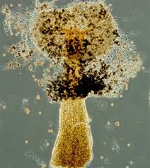 Attēlu rezultāti vaicājumam “Didymium bahiense spores”