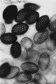Attēlu rezultāti vaicājumam “Didymium annulisporum spores”