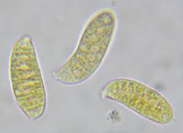 Attēlu rezultāti vaicājumam “Dacrymyces chrysospermus spores”