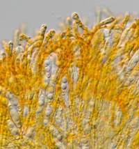 Attēlu rezultāti vaicājumam “Byssonectria fusispora”