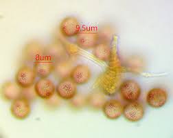 Attēlu rezultāti vaicājumam “Physarum pseudoalexandrowiczii”