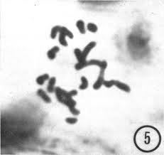 Attēlu rezultāti vaicājumam “Blasia pusilla sporophyte”