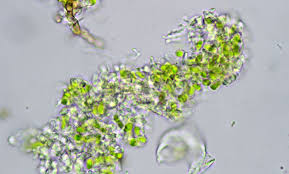 Attēlu rezultāti vaicājumam “Chaenotheca chlorella”