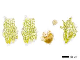 Attēlu rezultāti vaicājumam “Fossombronia foveolata spores”
