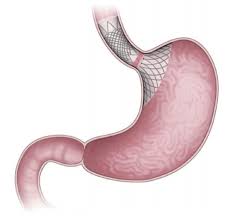 Image result for 뺾