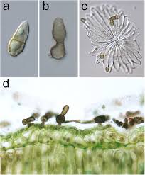 Attēlu rezultāti vaicājumam “Oligonema flavidum spores”