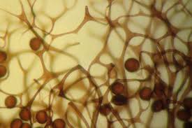 Attēlu rezultāti vaicājumam “Lamproderma ovoideum macro”