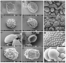 Attēlu rezultāti vaicājumam “Bartramia pomiformis sporophyte”