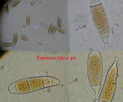 Attēlu rezultāti vaicājumam “Bactridium flavum”