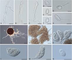 Attēlu rezultāti vaicājumam “Erysiphe galeopsidis”