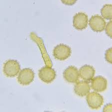 Attēlu rezultāti vaicājumam “Oligonema favogineum spores”