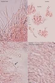 Attēlu rezultāti vaicājumam “Sistotrema confluens”