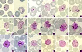 Attēlu rezultāti vaicājumam “Enteridium variabile plasmodium”