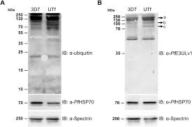 Attēlu rezultāti vaicājumam “Enteridium variabile plasmodium”