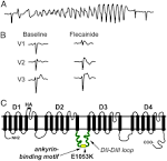 Nav1.5 E1053K mutation causing Brugada syndrome blocks binding to ... 