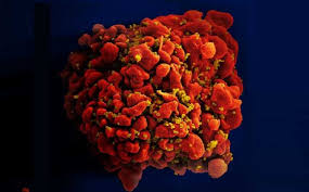 Image result for фотография вируса вич