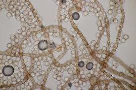 Attēlu rezultāti vaicājumam “Arcyria stipata spores”