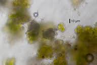 Attēlu rezultāti vaicājumam “Chaenotheca ferruginea”