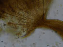 Attēlu rezultāti vaicājumam “Physarum bryocorticola spores”