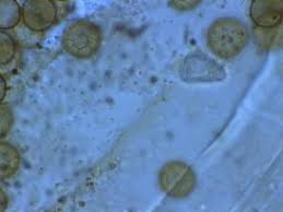 Attēlu rezultāti vaicājumam “Perichaena corticalis macro”