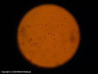 Attēlu rezultāti vaicājumam “Typhula setipes”