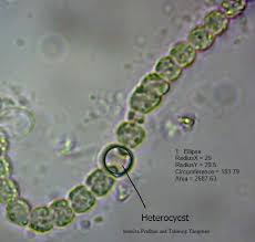 Attēlu rezultāti vaicājumam “Nostoc commune cells”