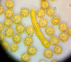 Attēlu rezultāti vaicājumam “Oligonema favogineum sessile”