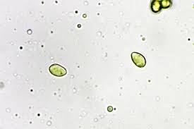 Attēlu rezultāti vaicājumam “Hemitrichia lutescens macro”