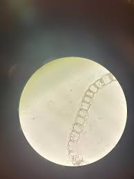 Attēlu rezultāti vaicājumam “Sphagnum compactum”