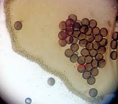 Attēlu rezultāti vaicājumam “Licea chelonoides spores”