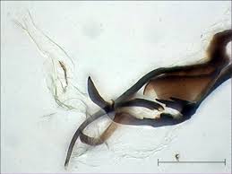 Attēlu rezultāti vaicājumam “Phytomyza minuscula”