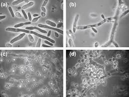 Attēlu rezultāti vaicājumam “Craterium minutum cf. var. brunneum spores”