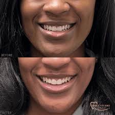 Bildergebnis für smile