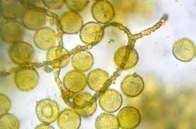 Attēlu rezultāti vaicājumam “Perichaena corticalis”