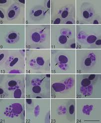 Attēlu rezultāti vaicājumam “Reticularia lobata plasmodium”