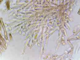 Attēlu rezultāti vaicājumam “Cribraria rubiginosa spores”