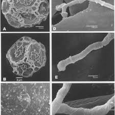 Attēlu rezultāti vaicājumam “Oligonema favogineum sessile”