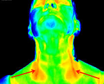 Image result for thermographie-aufnahmen