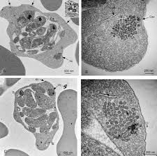 Attēlu rezultāti vaicājumam “Colloderma oculatum plasmodium”